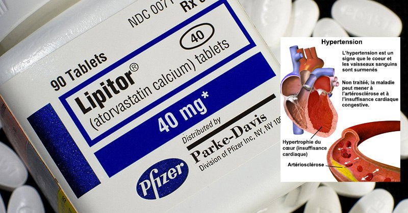 Etude : les statines n’abaissent pas le cholestérol mais augmentent le risque de cancer et de perte de mémoire
